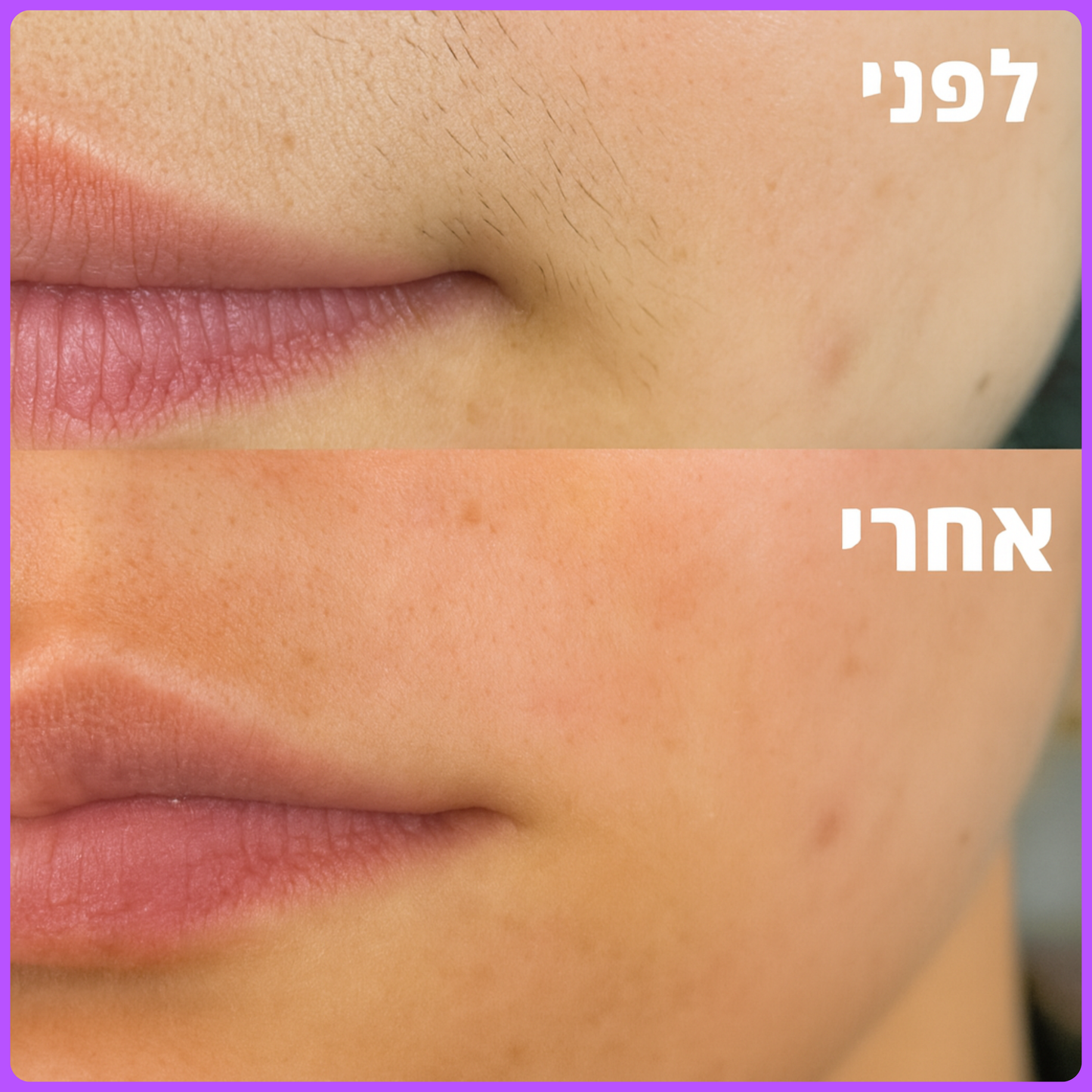 1+1 על הVeloraFace!